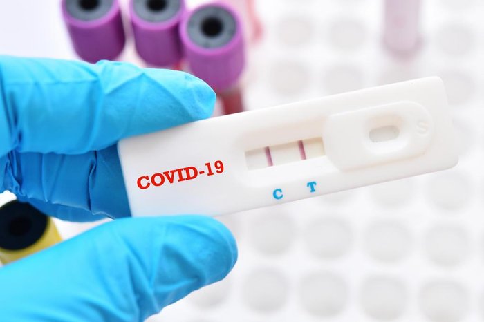 Alerta: Festas de Final de Ano Podem Agravar Contaminação por COVID-19 na Região