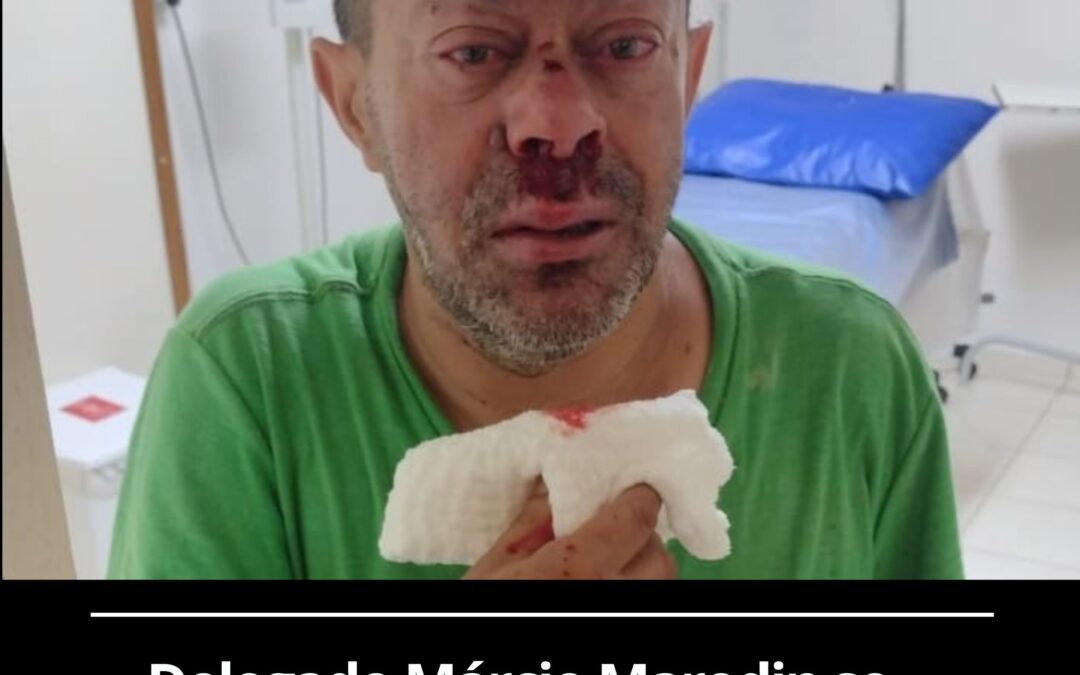 Delegado Márcio Marodin se manifesta sobre agressão a Luiz Alfredo, o “Macaquinho”