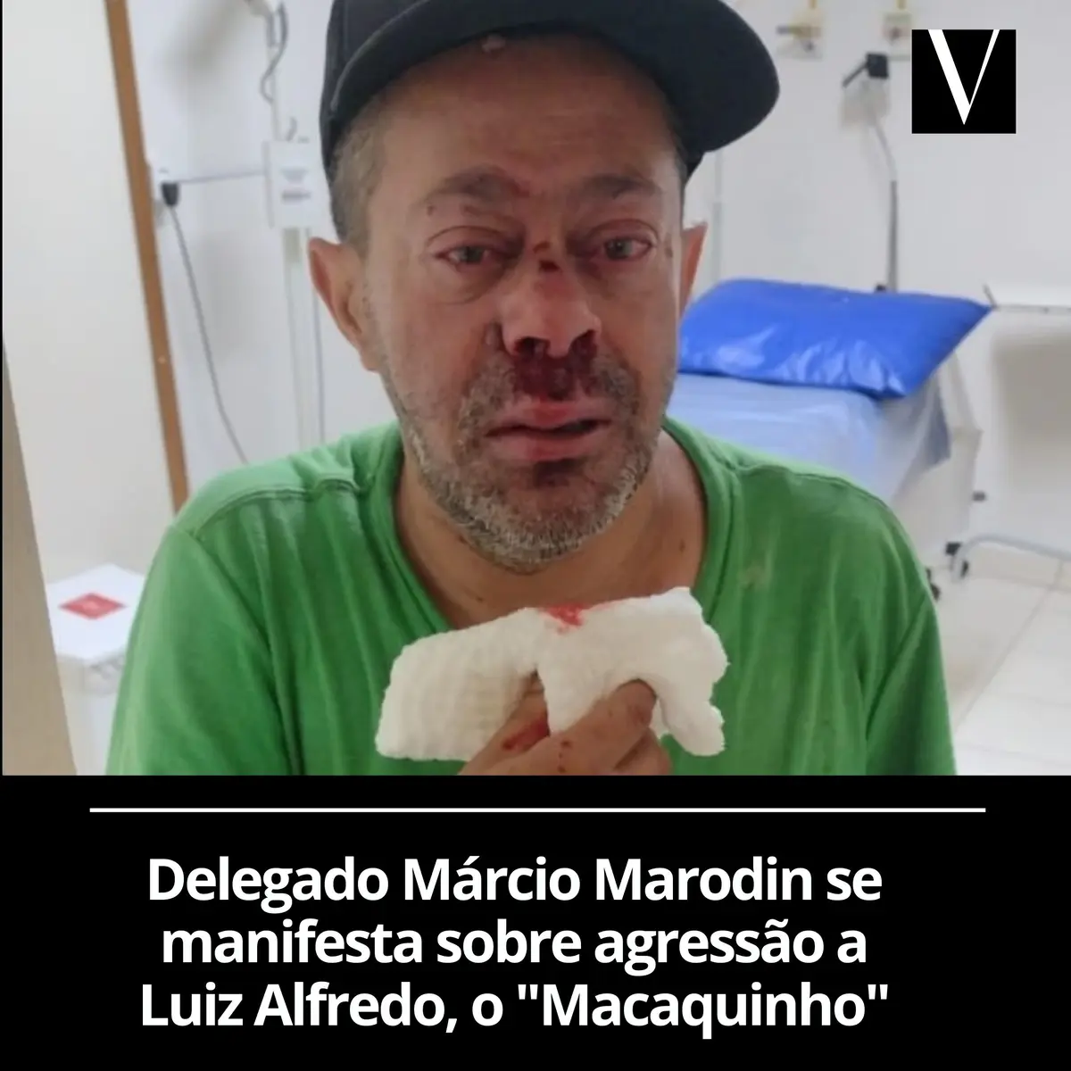 Delegado Márcio Marodin se manifesta sobre agressão a Luiz Alfredo, o “Macaquinho”